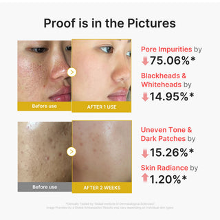 MEDICUBE - Kojic Acid Turmeric Peel Shot - 80ml