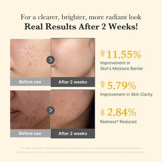 MEDICUBE - Kojic Acid Turmeric Niacinamide Serum - 30ml