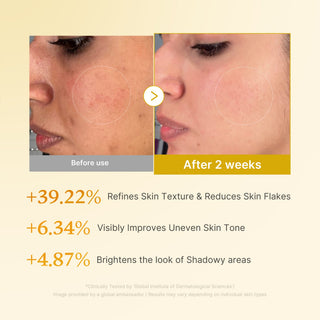 MEDICUBE - Kojic Acid Turmeric Resurfacing Toner - 250ml