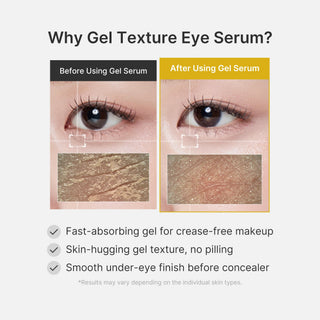 MEDICUBE - Kojic Acid Tumeric Eye Gel Serum - 30ml