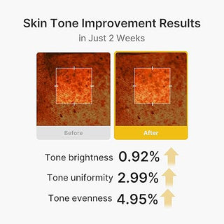 MEDICUBE - Kojic Acid Turmeric Vita Capsule Cream - 53gr