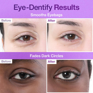 NUMBUZIN - No.9 NAD + Collagen Under Eye Patches - 1par