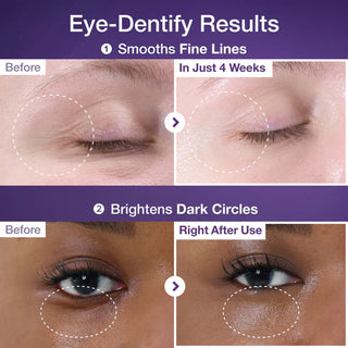 NUMBUZIN - Daily Eye Care Duo - 1 Eye Cream + 5 Pares de Parches