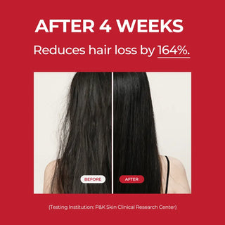 MOEV - ANNURCATIN™ Hair Tonic - 150ml