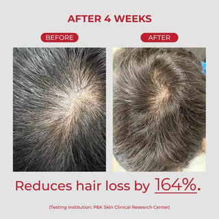 MOEV - ANNURCATIN™ Shampoo - 525ml