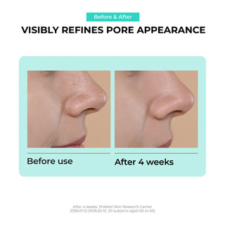 JUMISO - Overnight Zero Pore Nose Patch - 10parches