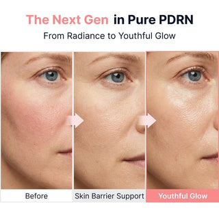 SUNGBOON EDITORS - PDRN Pink Vitamin Glow Boosting Ampoule - 40ml