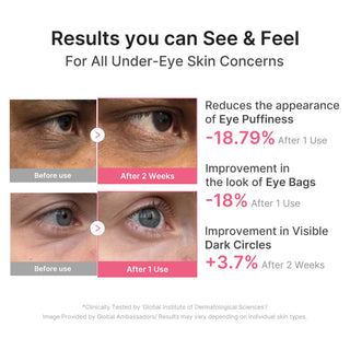 MEDICUBE - PDRN Pink Caffeine Collagen Eye Patch - 60pcs