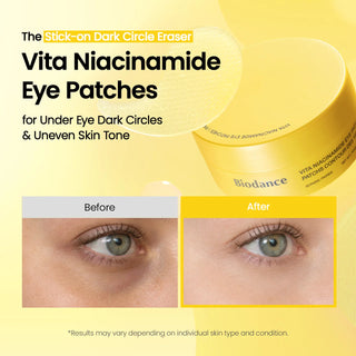 BIODANCE - Vita Niacinamide Eye Patches - 30pares