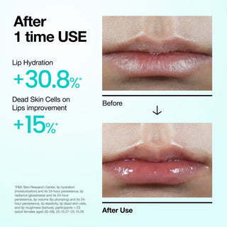 ANUA - PDRN Lip Serum - 10ml