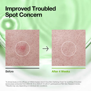 ANUA - Azelaic 3 Cica Skin Clarifying Toner - 250ml