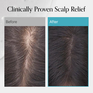 GROWUS - Recover Therapy Hair Booster Serum - 15ml